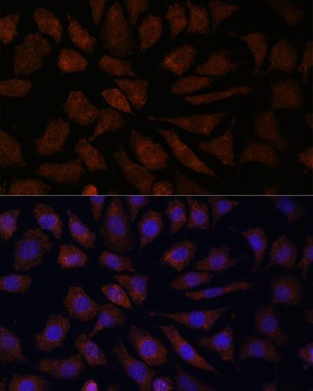 Anti-OAS3 Antibody (CAB9481)