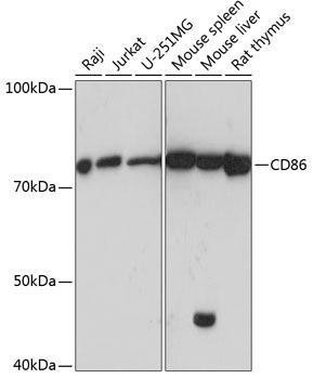 Anti-CD86 Monoclonal Antibody (CAB19026)
