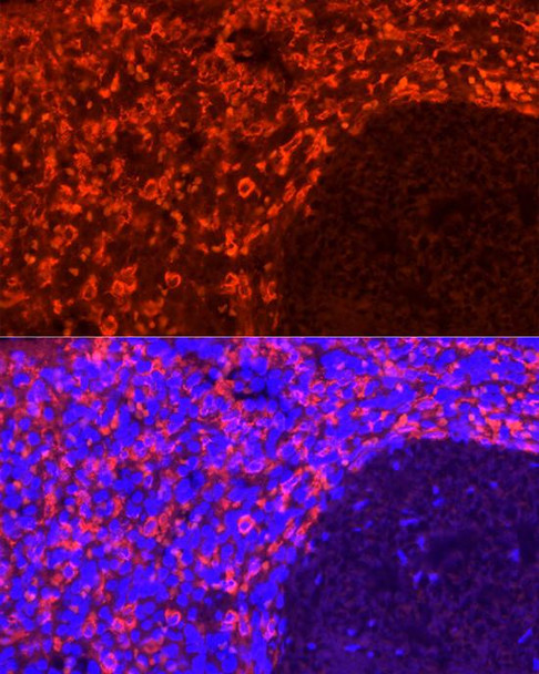 Anti-CD163 [ARC58325] Monoclonal Antibody (CAB22619)