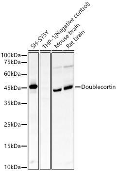 Anti-Doublecortin [ARC57902] Monoclonal Antibody (CAB23501)