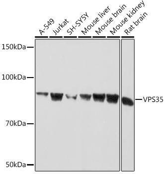 Anti-VPS35 [ARC1509] Monoclonal Antibody (CAB9278)