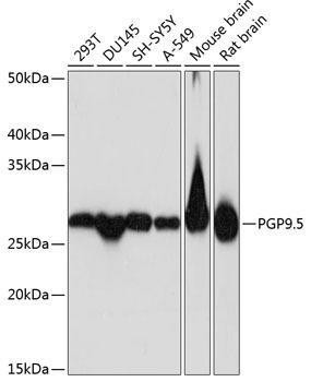 Anti-PGP9.5/UCHL1 Monoclonal Antibody (CAB19101)