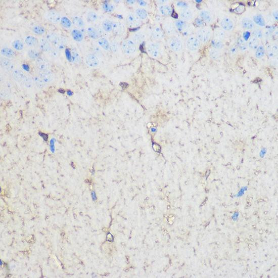 Anti-S100B Antibody (CAB0676)