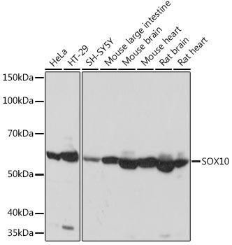 Anti-SOX10 [ARC1767] Monoclonal Antibody (CAB8655)