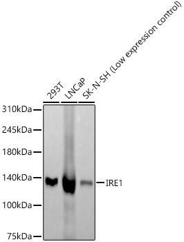 Anti-IRE1 [ARC57190] Monoclonal Antibody (CAB21021)
