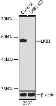 Anti-LKB1 Antibody -Knockout Validated (CAB2122)