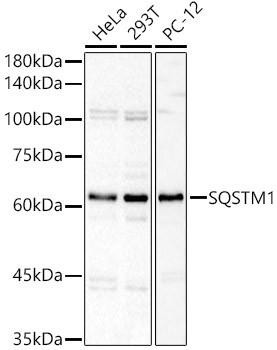 Anti-SQSTM1 Polyclonal Antibody (CAB22025)