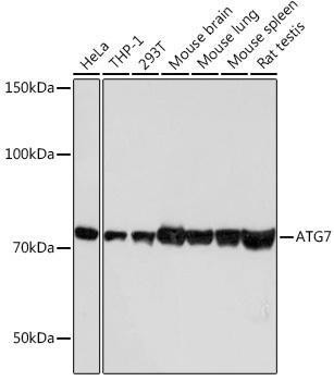 Anti-ATG7 Monoclonal Antibody (CAB19604)