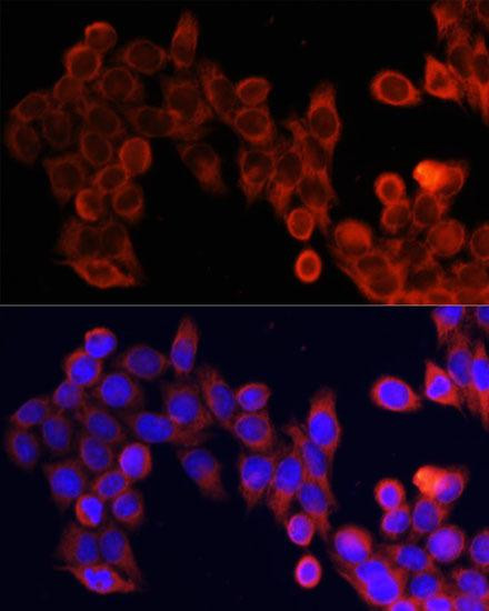Anti-mTOR Polyclonal Antibody (CAB2445)