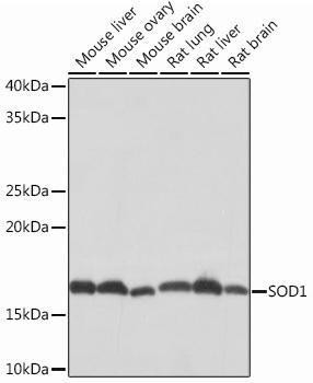 Anti-SOD1 [ARC51789] Monoclonal Antibody (CAB12537)