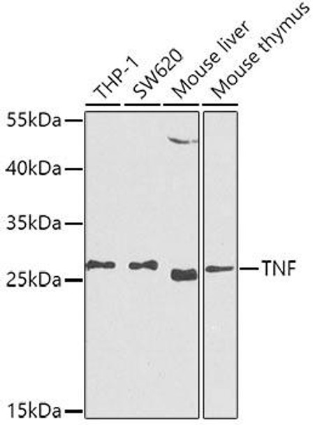 Anti-TNF-Alpha Antibody (CAB0277)