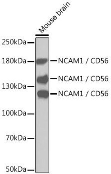 Anti-NCAM1 / CD56 Antibody (CAB0393)