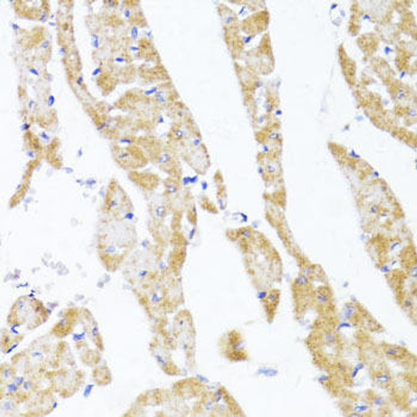 Anti-EGLN1/EGLN2 Antibody (CAB10342)