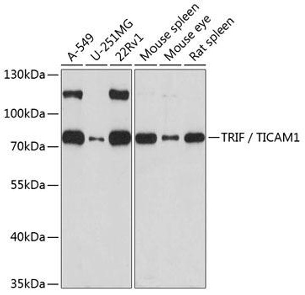 Anti-TRIF / TICAM1 Antibody (CAB1155)