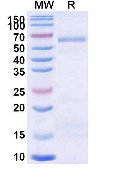 Anti-Trastuzumab Idiotypic Antibody [1HE]