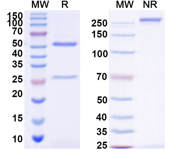 Anti-Siltuximab Neutralizing Antibody [1A455]