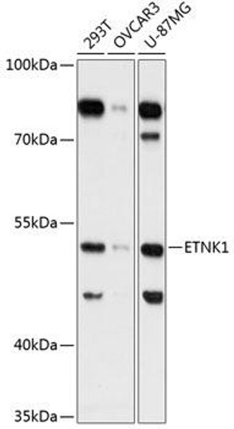 Anti-ETNK1 Antibody (CAB13224)