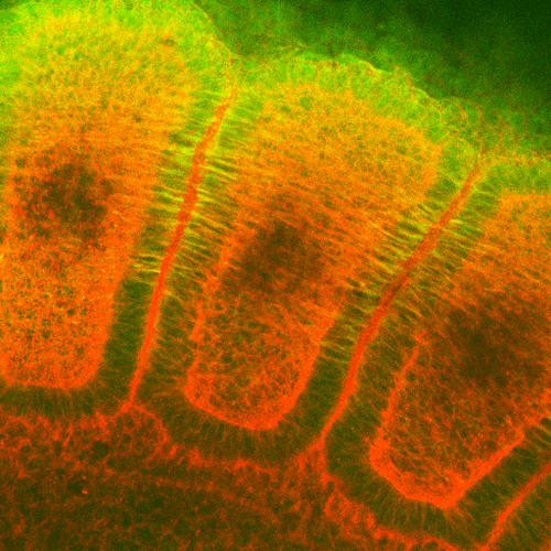 Immunohistochemistry analysis using Mouse Anti-Hsp27 Monoclonal Antibody, Clone 8A7 (STMA00010). Tissue: embryo somites. Species: Rat. Primary Antibody: Mouse Anti-Hsp27 Monoclonal Antibody (STMA00010) at 1:1000. Secondary Antibody: FITC Goat Anti-Mouse (green). Counterstain: Rhodamine-phalloidin labeled actin (red). Investigation at 11 days gestation. Courtesy of: Mike Welsh, Umich.