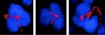 Immunocytochemistry/Immunofluorescence analysis using Mouse Anti-FKBP51 Monoclonal Antibody, Clone Hi51B (STMA00021). Tissue: MK cells. Species: Mouse. Primary Antibody: Mouse Anti-FKBP51 Monoclonal Antibody (STMA00021) at 1:1000. Secondary Antibody: APC Goat Anti-Mouse (red). Counterstain: DAPI (blue) nuclear stain. Cells stained red. Courtesy of: the Hospital Henri Mondor, France.