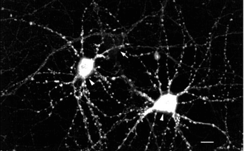 Immunocytochemistry/Immunofluorescence analysis using Mouse Anti-CaMKII Monoclonal Antibody, Clone 22B1 (STMA00016). Tissue: dissociated hippocampal neurons. Species: Rat. Fixation: Cold 4% paraformaldehyde/0.2% glutaraldehyde in 0.1M sodium phosphate buffer. Primary Antibody: Mouse Anti-CaMKII Monoclonal Antibody (STMA00016) at 1:1000 for 12 hours at 4°C. Secondary Antibody: FITC Goat Anti-Mouse IgG (green) at 1:50 for 30 minutes at RT.
