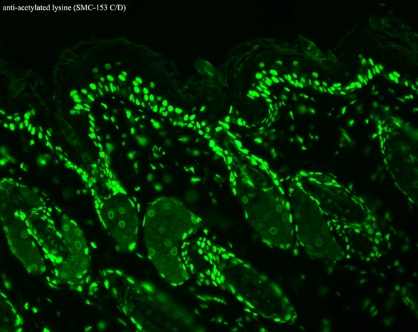 Immunohistochemistry analysis using Mouse Anti-Acetylated Lysine Monoclonal Antibody, Clone 7F8 (STMA00032). Tissue: backskin. Species: Mouse. Fixation: Bouin's Fixative and paraffin-embedded. Primary Antibody: Mouse Anti-Acetylated Lysine Monoclonal Antibody (STMA00032) at 1:100 for 1 hour at RT. Secondary Antibody: FITC Goat Anti-Mouse (green) at 1:50 for 1 hour at RT. Backskin obtained from transgenic mice.