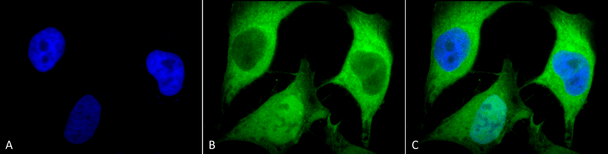 Immunocytochemistry/Immunofluorescence analysis using Mouse Anti-Ubiquitin Monoclonal Antibody, Clone 5B9-B3 (STMA00036). Tissue: Cervical cancer cell line (HeLa). Species: Human. Fixation: 2% Formaldehyde for 20 min at RT. Primary Antibody: Mouse Anti-Ubiquitin Monoclonal Antibody (STMA00036) at 1:100 for 12 hours at 4°C. Secondary Antibody: FITC Goat Anti-Mouse (green) at 1:200 for 2 hours at RT.