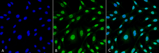 Immunocytochemistry/Immunofluorescence analysis using Mouse Anti-HO-1 (Rat) Monoclonal Antibody, Clone 6B8-2F2 (STMA00068). Tissue: Fibroblast cell line (NIH 3T3). Species: Mouse. Fixation: 4% Formaldehyde for 15 min at RT. Primary Antibody: Mouse Anti-HO-1 (Rat) Monoclonal Antibody (STMA00068) at 1:100 for 60 min at RT. Secondary Antibody: Goat Anti-Mouse ATTO 488 at 1:100 for 60 min at RT.