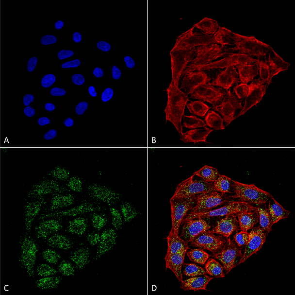 Immunocytochemistry/Immunofluorescence analysis using Mouse Anti-CD74 Monoclonal Antibody, Clone 1B8 (STMA00077). Tissue: Cervical cancer cell line (HeLa). Species: Human. Fixation: 4% Formaldehyde for 15 min at RT. Primary Antibody: Mouse Anti-CD74 Monoclonal Antibody (STMA00077) at 1:100 for 60 min at RT. Secondary Antibody: Goat Anti-Mouse ATTO 488 at 1:200 for 60 min at RT.