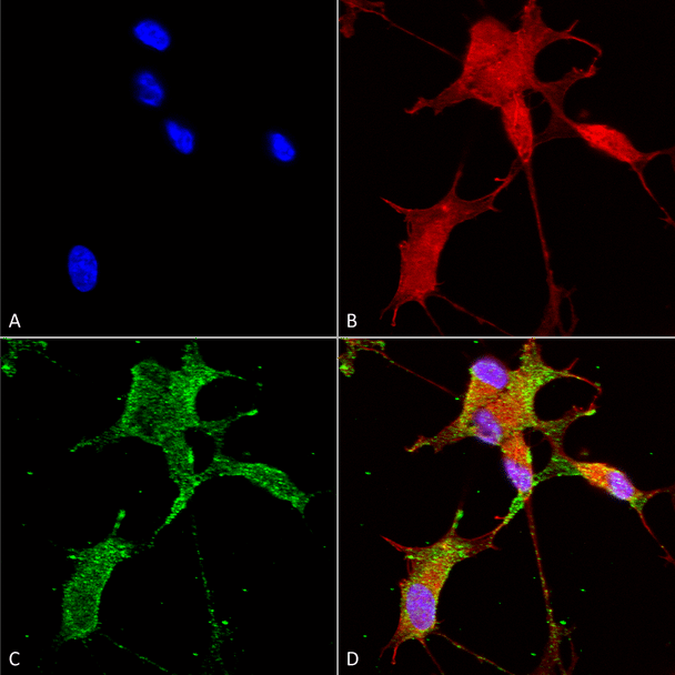 Immunocytochemistry/Immunofluorescence analysis using Mouse Anti-Cav3.2 Monoclonal Antibody, Clone N55/10 (STMA00082). Tissue: Neuroblastoma cells (SH-SY5Y). Species: Human. Fixation: 4% PFA for 15 min. Primary Antibody: Mouse Anti-Cav3.2 Monoclonal Antibody (STMA00082) at 1:50 for overnight at 4°C with slow rocking. Secondary Antibody: AlexaFluor 488 at 1:1000 for 1 hour at RT.