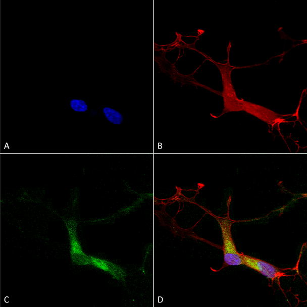 Immunocytochemistry/Immunofluorescence analysis using Mouse Anti-HCN1 Monoclonal Antibody, Clone S70 (STMA00083). Tissue: Neuroblastoma cells (SH-SY5Y). Species: Human. Fixation: 4% PFA for 15 min. Primary Antibody: Mouse Anti-HCN1 Monoclonal Antibody (STMA00083) at 1:100 for overnight at 4°C with slow rocking. Secondary Antibody: AlexaFluor 488 at 1:1000 for 1 hour at RT.