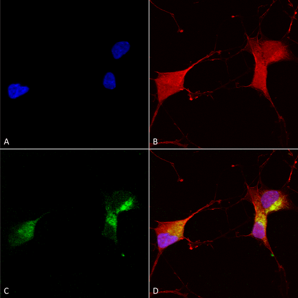 Immunocytochemistry/Immunofluorescence analysis using Mouse Anti-KCNQ1 Monoclonal Antibody, Clone N37A/10 (STMA00085). Tissue: Neuroblastoma cells (SH-SY5Y). Species: Human. Fixation: 4% PFA for 15 min. Primary Antibody: Mouse Anti-KCNQ1 Monoclonal Antibody (STMA00085) at 1:100 for overnight at 4°C with slow rocking. Secondary Antibody: AlexaFluor 488 at 1:1000 for 1 hour at RT.