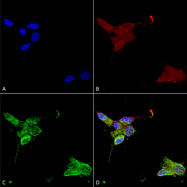 Immunocytochemistry/Immunofluorescence analysis using Mouse Anti-TrpM7 Monoclonal Antibody, Clone S74 (STMA00089). Tissue: Neuroblastoma cells (SH-SY5Y). Species: Human. Fixation: 4% PFA for 15 min. Primary Antibody: Mouse Anti-TrpM7 Monoclonal Antibody (STMA00089) at 1:50 for overnight at 4°C with slow rocking. Secondary Antibody: AlexaFluor 488 at 1:1000 for 1 hour at RT.