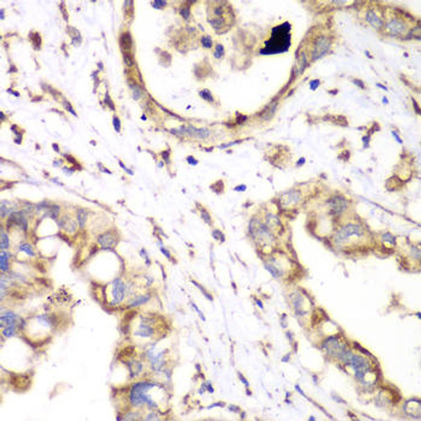 Anti-HADHA Antibody (CAB13310)