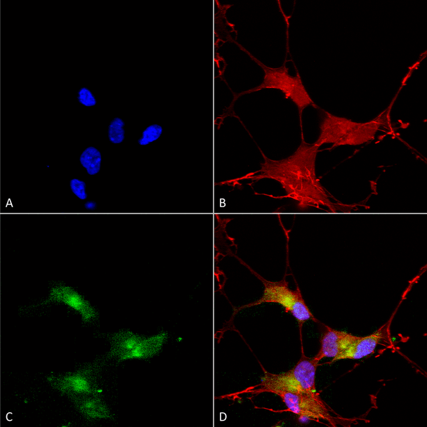 Immunocytochemistry/Immunofluorescence analysis using Mouse Anti-SHANK3 Monoclonal Antibody, Clone S69-46 (STMA00097). Tissue: Neuroblastoma cells (SH-SY5Y). Species: Human. Fixation: 4% PFA for 15 min. Primary Antibody: Mouse Anti-SHANK3 Monoclonal Antibody (STMA00097) at 1:50 for overnight at 4°C with slow rocking. Secondary Antibody: AlexaFluor 488 at 1:1000 for 1 hour at RT.