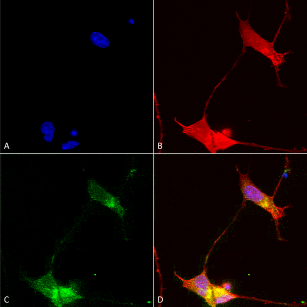 Immunocytochemistry/Immunofluorescence analysis using Mouse Anti-SHANK (pan) Monoclonal Antibody, Clone S23b-49 (STMA00093). Tissue: Neuroblastoma cells (SH-SY5Y). Species: Human. Fixation: 4% PFA for 15 min. Primary Antibody: Mouse Anti-SHANK (pan) Monoclonal Antibody (STMA00093) at 1:50 for overnight at 4°C with slow rocking. Secondary Antibody: AlexaFluor 488 at 1:1000 for 1 hour at RT.