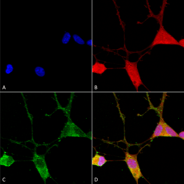Immunocytochemistry/Immunofluorescence analysis using Mouse Anti-VGLUT1 Monoclonal Antibody, Clone N28/9 (STMA00109). Tissue: Neuroblastoma cells (SH-SY5Y). Species: Human. Fixation: 4% PFA for 15 min. Primary Antibody: Mouse Anti-VGLUT1 Monoclonal Antibody (STMA00109) at 1:100 for overnight at 4°C with slow rocking. Secondary Antibody: AlexaFluor 488 at 1:1000 for 1 hour at RT.