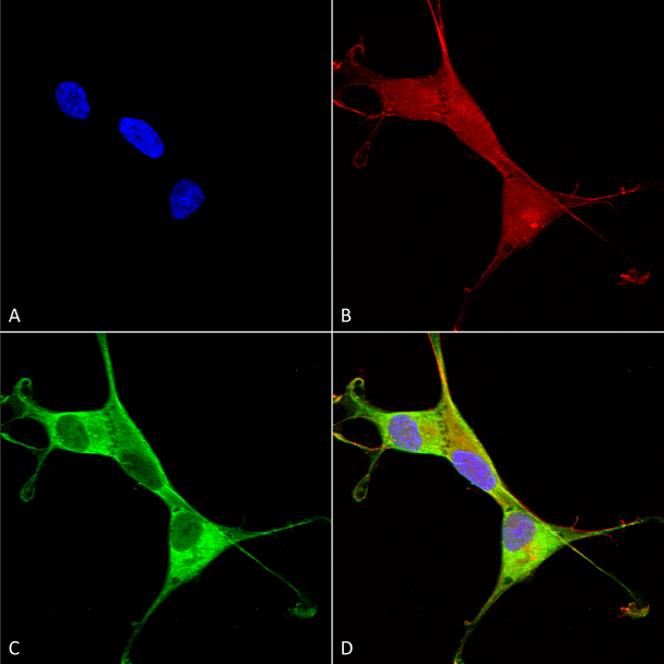 Immunocytochemistry/Immunofluorescence analysis using Mouse Anti-Copper Transporting ATPase 1 Monoclonal Antibody, Clone L60/4 (STMA00113). Tissue: Neuroblastoma cells (SH-SY5Y). Species: Human. Fixation: 4% PFA for 15 min. Primary Antibody: Mouse Anti-Copper Transporting ATPase 1 Monoclonal Antibody (STMA00113) at 1:100 for overnight at 4°C with slow rocking. Secondary Antibody: AlexaFluor 488 at 1:1000 for 1 hour at RT.