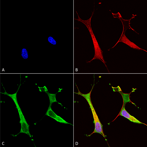 Immunocytochemistry/Immunofluorescence analysis using Mouse Anti-Copper Transporting ATPase 2 Monoclonal Antibody, Clone L62/29 (STMA00114). Tissue: Neuroblastoma cells (SH-SY5Y). Species: Human. Fixation: 4% PFA for 15 min. Primary Antibody: Mouse Anti-Copper Transporting ATPase 2 Monoclonal Antibody (STMA00114) at 1:100 for overnight at 4°C with slow rocking. Secondary Antibody: AlexaFluor 488 at 1:1000 for 1 hour at RT.