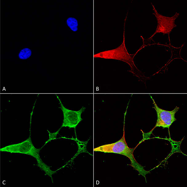 Immunocytochemistry/Immunofluorescence analysis using Mouse Anti-Ankyrin B Monoclonal Antibody, Clone N105/13 (STMA00115). Tissue: Neuroblastoma cells (SH-SY5Y). Species: Human. Fixation: 4% PFA for 15 min. Primary Antibody: Mouse Anti-Ankyrin B Monoclonal Antibody (STMA00115) at 1:50 for overnight at 4°C with slow rocking. Secondary Antibody: AlexaFluor 488 at 1:1000 for 1 hour at RT.