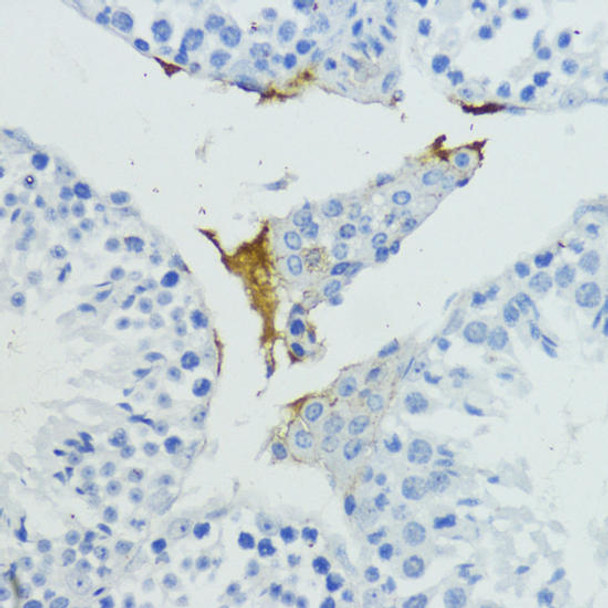 Anti-KLKB1 Antibody (CAB13322)