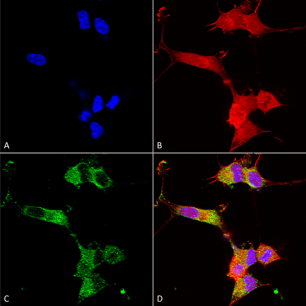 Immunocytochemistry/Immunofluorescence analysis using Mouse Anti-NALCN Monoclonal Antibody, Clone N187/7 (STMA00127). Tissue: Neuroblastoma cells (SH-SY5Y). Species: Human. Fixation: 4% PFA for 15 min. Primary Antibody: Mouse Anti-NALCN Monoclonal Antibody (STMA00127) at 1:100 for overnight at 4°C with slow rocking. Secondary Antibody: AlexaFluor 488 at 1:1000 for 1 hour at RT.