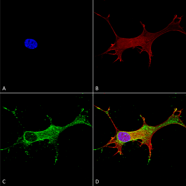 Immunocytochemistry/Immunofluorescence analysis using Mouse Anti-Notch1 Monoclonal Antibody, Clone N253/32 (STMA00135). Tissue: Neuroblastoma cells (SH-SY5Y). Species: Human. Fixation: 4% PFA for 15 min. Primary Antibody: Mouse Anti-Notch1 Monoclonal Antibody (STMA00135) at 1:50 for overnight at 4°C with slow rocking. Secondary Antibody: AlexaFluor 488 at 1:1000 for 1 hour at RT.