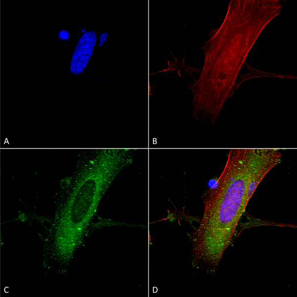 Immunocytochemistry/Immunofluorescence analysis using Mouse Anti-GluN2A Monoclonal Antibody, Clone N327A/38 (STMA00137). Tissue: Neuroblastoma cells (SH-SY5Y). Species: Human. Fixation: 4% PFA for 15 min. Primary Antibody: Mouse Anti-GluN2A Monoclonal Antibody (STMA00137) at 1:100 for overnight at 4°C with slow rocking. Secondary Antibody: AlexaFluor 488 at 1:1000 for 1 hour at RT.