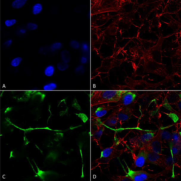Immunocytochemistry/Immunofluorescence analysis using Mouse Anti-ATF4 Monoclonal Antibody, Clone N360A/24 (STMA00146). Tissue: Neuroblastoma cells (SH-SY5Y). Species: Human. Fixation: 4% PFA for 15 min. Primary Antibody: Mouse Anti-ATF4 Monoclonal Antibody (STMA00146) at 1:200 for overnight at 4°C with slow rocking. Secondary Antibody: AlexaFluor 488 at 1:1000 for 1 hour at RT.