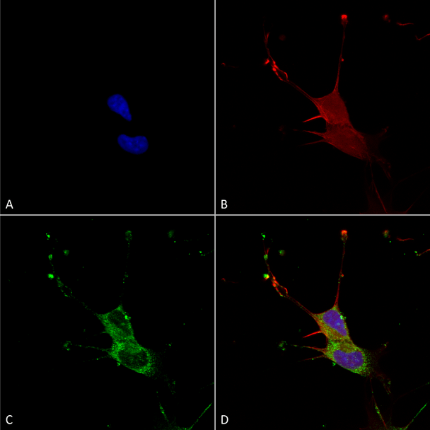 Immunocytochemistry/Immunofluorescence analysis using Mouse Anti-LGI1 Monoclonal Antibody, Clone N283/7 (STMA00154). Tissue: Neuroblastoma cells (SH-SY5Y). Species: Human. Fixation: 4% PFA for 15 min. Primary Antibody: Mouse Anti-LGI1 Monoclonal Antibody (STMA00154) at 1:100 for overnight at 4°C with slow rocking. Secondary Antibody: AlexaFluor 488 at 1:1000 for 1 hour at RT.