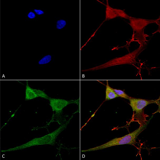 Immunocytochemistry/Immunofluorescence analysis using Mouse Anti-NrCAM Monoclonal Antibody, Clone N364/51 (STMA00155). Tissue: Neuroblastoma cells (SH-SY5Y). Species: Human. Fixation: 4% PFA for 15 min. Primary Antibody: Mouse Anti-NrCAM Monoclonal Antibody (STMA00155) at 1:100 for overnight at 4°C with slow rocking. Secondary Antibody: AlexaFluor 488 at 1:1000 for 1 hour at RT.