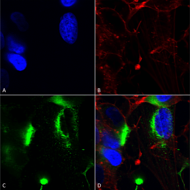 Immunocytochemistry/Immunofluorescence analysis using Mouse Anti-QKI (pan) Monoclonal Antibody, Clone N147/6 (STMA00157). Tissue: Neuroblastoma cells (SH-SY5Y). Species: Human. Fixation: 4% PFA for 15 min. Primary Antibody: Mouse Anti-QKI (pan) Monoclonal Antibody (STMA00157) at 1:200 for overnight at 4°C with slow rocking. Secondary Antibody: AlexaFluor 488 at 1:1000 for 1 hour at RT.