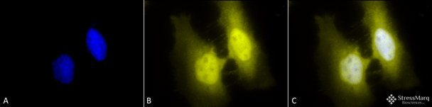 Immunocytochemistry/Immunofluorescence analysis using Rat Anti-HSF1 Monoclonal Antibody, Clone 4B4 (STMA00163). Tissue: Heat Shocked cervical cancer cells (HeLa). Species: Human. Fixation: 2% Formaldehyde for 20 min at RT. Primary Antibody: Rat Anti-HSF1 Monoclonal Antibody (STMA00163) at 1:100 for 12 hours at 4°C. Secondary Antibody: R-PE Goat Anti-Rat (yellow) at 1:200 for 2 hours at RT.