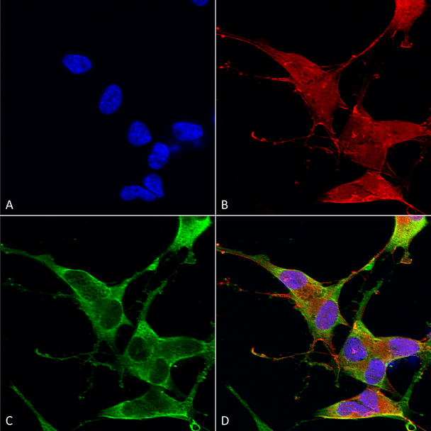 Immunocytochemistry/Immunofluorescence analysis using Mouse Anti-Ankyrin R Monoclonal Antibody, Clone N388A/10 (STMA00167). Tissue: Neuroblastoma cells (SH-SY5Y). Species: Human. Fixation: 4% PFA for 15 min. Primary Antibody: Mouse Anti-Ankyrin R Monoclonal Antibody (STMA00167) at 1:100 for overnight at 4°C with slow rocking. Secondary Antibody: AlexaFluor 488 at 1:1000 for 1 hour at RT.