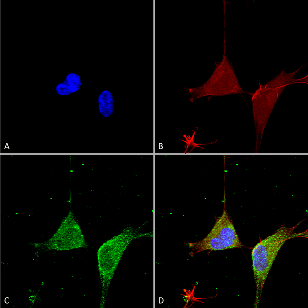 Immunocytochemistry/Immunofluorescence analysis using Mouse Anti-GABA A Receptor Alpha 5 Monoclonal Antibody, Clone N415/24 (STMA00171). Tissue: Neuroblastoma cells (SH-SY5Y). Species: Human. Fixation: 4% PFA for 15 min. Primary Antibody: Mouse Anti-GABA A Receptor Alpha 5 Monoclonal Antibody (STMA00171) at 1:50 for overnight at 4°C with slow rocking. Secondary Antibody: AlexaFluor 488 at 1:1000 for 1 hour at RT.
